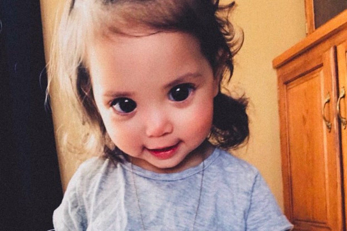 This Little Girl's Big, Beautiful Eyes Are Due To A Rare Genetic Syndrome
